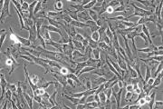 间充质干细胞：人体干细胞中的“孙悟空”