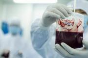权威专家公开表明对存脐带血的态度——脐带干细胞储存